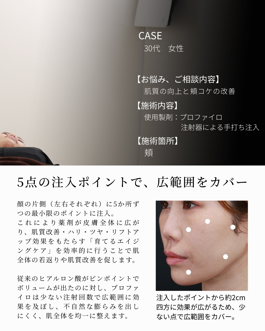 プロファイロの症例写真 施術前後 