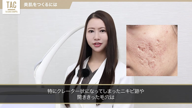 ニキビ跡と毛穴の悩みを示す説明画面