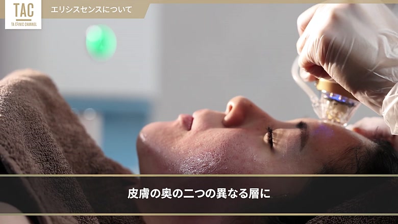 エリシスセンスの施術イメージ