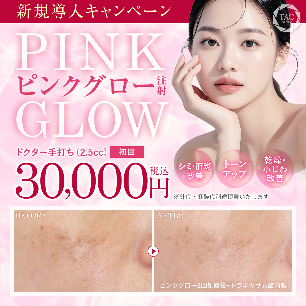 ピンクグロー_キャンペーン価格