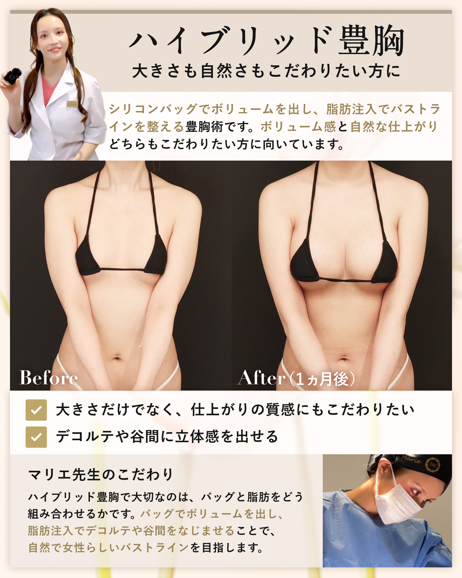 シリコンバッグ豊胸（人工乳腺バッグ）/脂肪注入豊胸（コンデンスリッチ・ピュアグラフト・１day脂肪豊胸）の症例写真 施術前後 