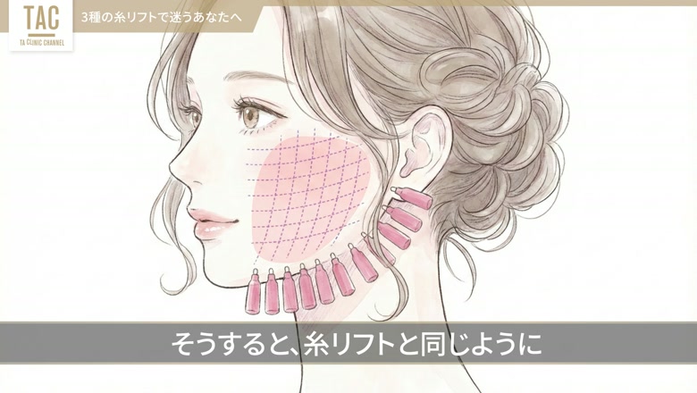 フェイスラインのたるみやすい部位を示す図