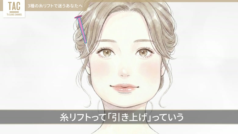 きれいなリフトアップのイメージ図