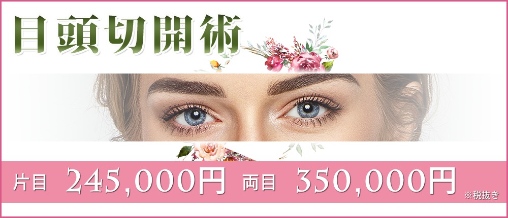目頭切開術