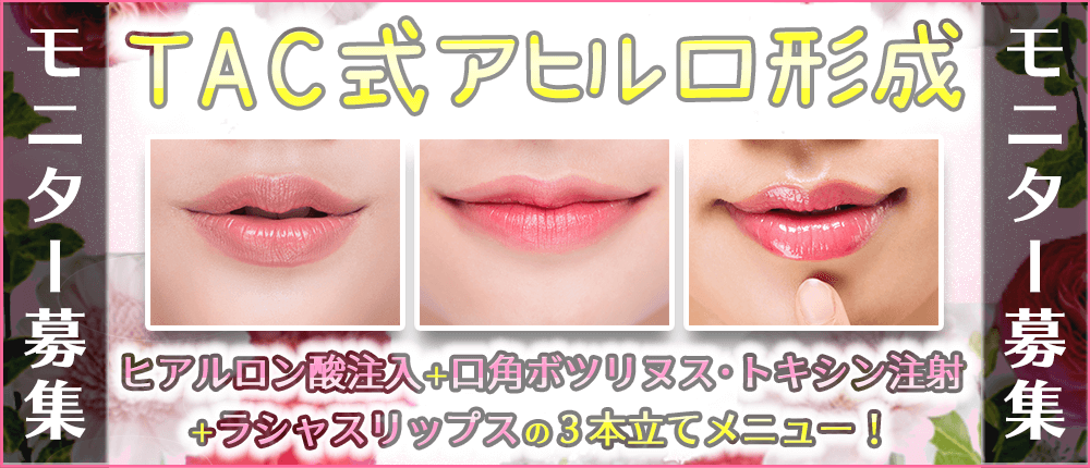 TAC式アヒル口形成モニター募集!愛されリップを手に入れよう!