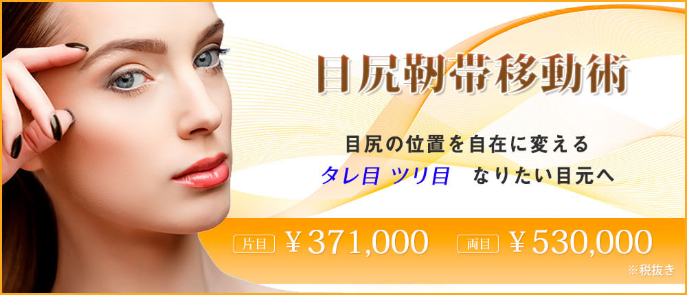 目尻靭帯移動術